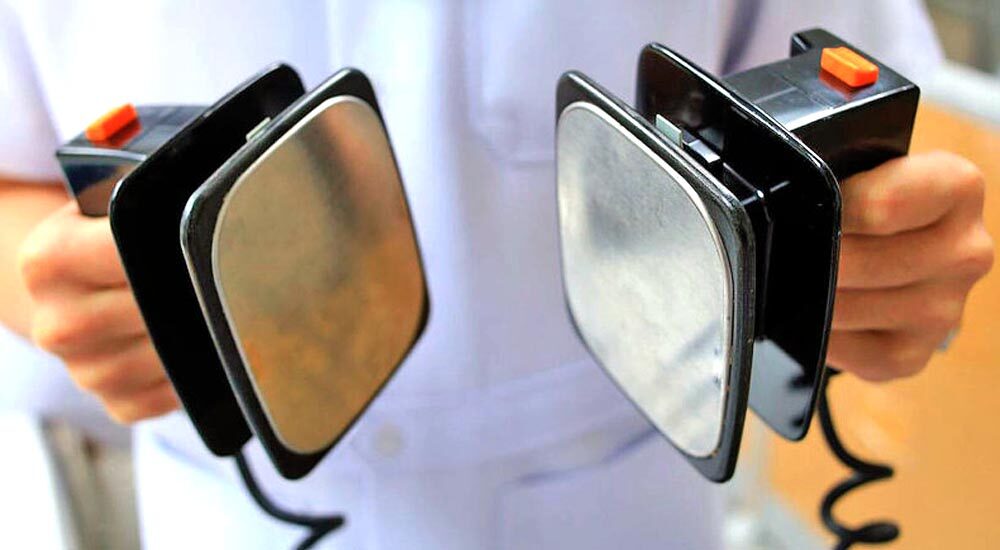 Лікарні у прифронтових областях отримали автоматичні дефібрилятори від ЄС